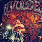 avulsed pic 1